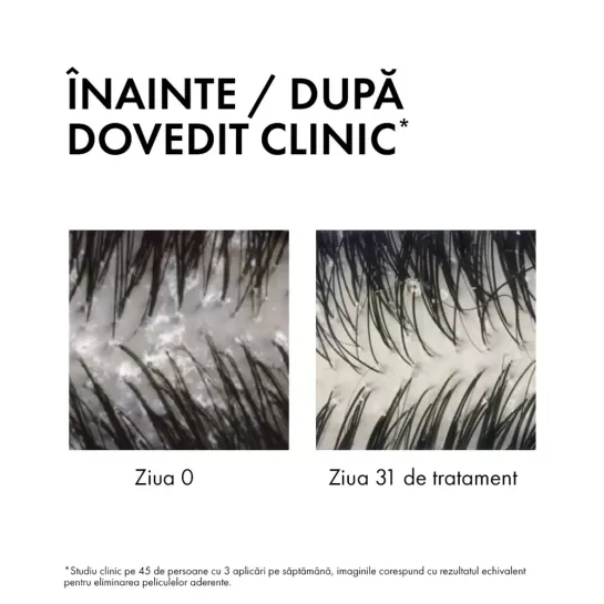 Vichy Dercos, sampon si balsam antimătreată 2 in 1, 200ml